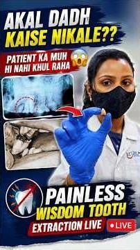 😱 Patient’s Mouth Won’t Open! How Did I Extract the Wisdom Tooth? | Painless Wisdom Tooth Extract...