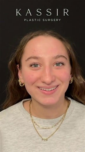 Rhinoplasty Reveal | Dr. Ramtin Kassir | New York City #shorts