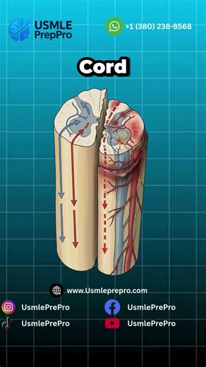Brown-Séquard Syndrome: High-Yield Anatomy Map for USMLE