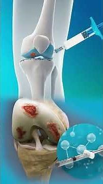 Best Knee Injection for You | Dr. Aditya Kapoor Explains