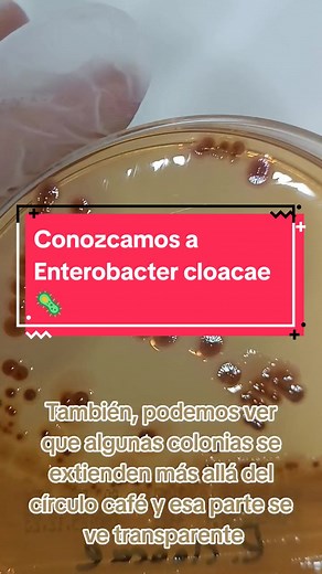 Cómo identificar Enterobacter cloacae en agar Salmonella