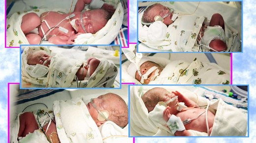 Alabama woman gives birth to sextuplets: Now she's a mother of 9