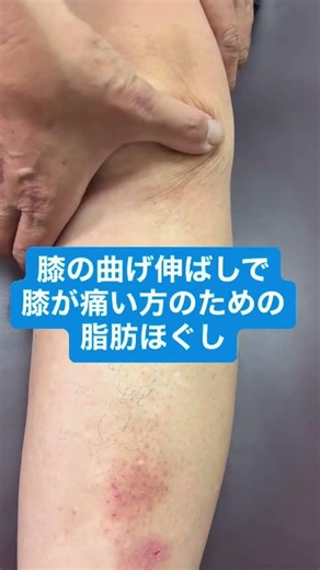 膝の曲げ伸ばしで膝の痛みが出るあなたへ