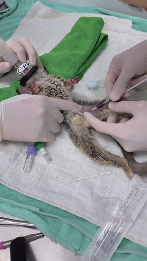 Jaturun Luapan on Instagram: "𝐁𝐥𝐢𝐧𝐝 𝐟𝐞𝐦𝐨𝐫𝐚𝐥 𝐚𝐫𝐭𝐞𝐫𝐢𝐚𝐥 𝐛𝐥𝐨𝐨𝐝 𝐬𝐚𝐦𝐩𝐥𝐢𝐧𝐠 𝐢𝐧 𝐁𝐮𝐬𝐡 𝐛𝐚𝐛𝐲 It's a blind technique, requiring a keen sense of touch. First, gently palpate the femoral pulse along the length of the femur. Once located, insert your needle at a 20-30 degree angle. Apply slight negative pressure by drawing the plunger back just a touch. Then, slowly and carefully advance the needle cranially towards the inguinal area until you hit that arterial "flash"