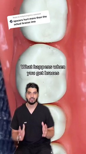 Dealing with Spacers: The Painful Process Explained