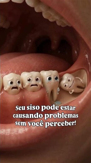 Seu siso pode estar causando problemas sem você perceber. 🦷