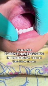 If your child’s teeth don’t have spacing, it could mean…  Did you...