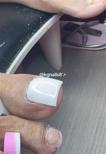 Satisfying Toe Clean-Up and Acrylic Removal Process