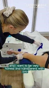 PRP / PRF Blood Draw for Morpheus8 | Is It Painful? Full Real Process