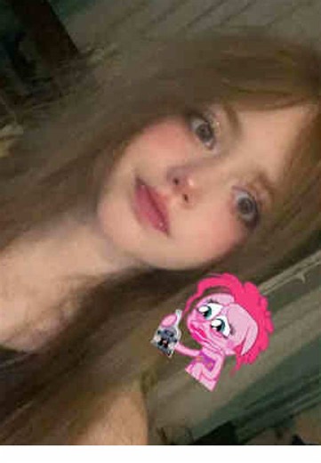 tgk paroxides | teeth hydrogen peroxide