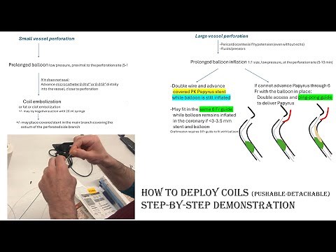 Coronary perforation