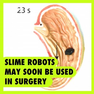 85K views · 208 reactions | Slime na gumagalaw at kayang humawak ng maliliit na bagay ang naimbento sa Chinese University of Hong Kong. Pinag-aaralan kung posible itong magamit sa mga pasyenteng aksidenteng nakalunok ng foreign objects. Panoorin ang video! #NextNow | GMA News | Facebook