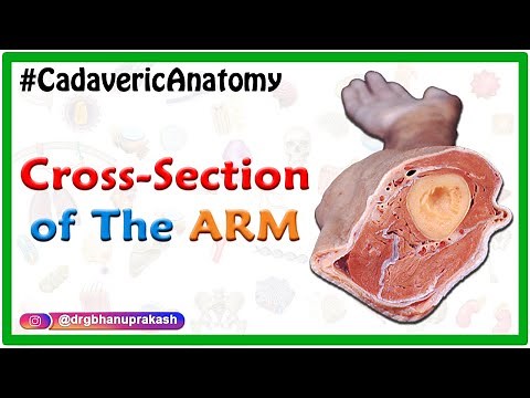 Cross-section of the Arm : Cadaveric Anatomy