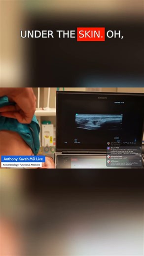 OUCH! 😣 Ultrasound of my rib