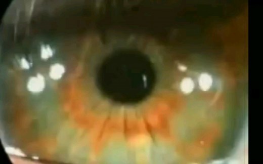 Pink Floyd - Brain Damage/Eclipse Full Music Video