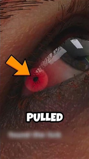 Ticks Don’t Jump Onto You, They Get Pulled In 😱