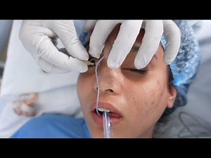 Pretty Girl Going into Anesthesia for Rhinoplasty Surgery