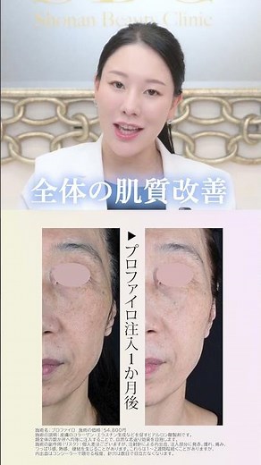[Skin Rejuvenation Injection] Profilo: A beauty treatment for sagging skin that rejuvenates from ...