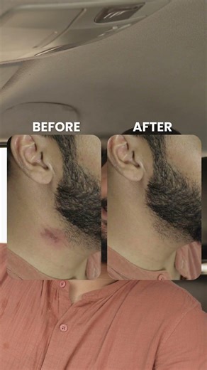 Hickey Spotted… Gone in Seconds 😳