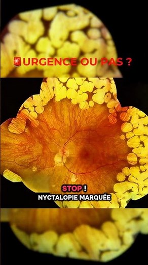 🧠 URGENCE OU PAS ?
