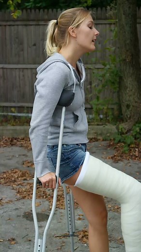 #firsttimeoncrutches #LongLegCast @vikaq498 | crutches