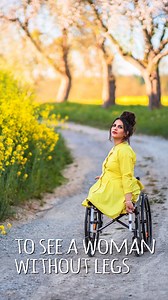 I lost both my legs at 18 😔 #fbreels #dysmelia #prosthetics #prostheticleg #viral | Shake My Beauty