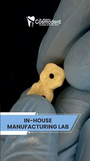 A Titanium Bar With Zirconia Support | Dental Implant | Dr. Richa Cosmodent