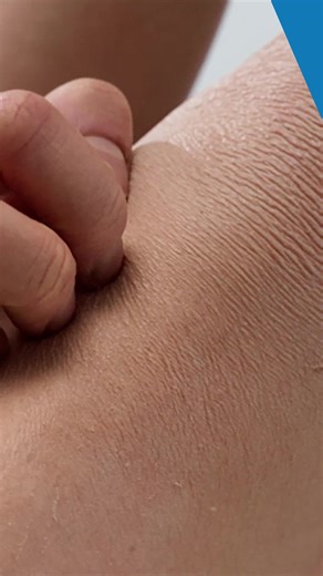 Understanding Different Types of Dry Skin Issues