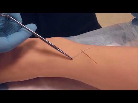 Simple Interrupted Sutures