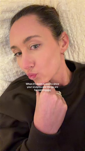 Cheeks made by me (and sculptra)