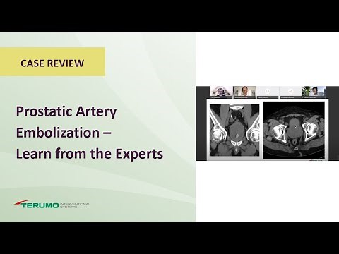 Prostatic Artery Embolization - Learn from the Experts | Terumo Interventional Systems