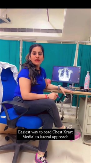 Understanding Chest X-Rays for Medical Students