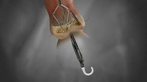 Leaflex Performer | Pi-Cardia