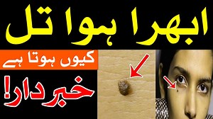 Til Masa Kiyo Hota Hai ilm e Jafar Til Ka Matlab astrology تل mole til ka nishan Mehrban Ali Apni Marzi ke Rishte Hasil Krain Free Registration Shadi Form https://mehrbanshadi.com WhatsApp : 92 309 999 11 77 Call : 92 304 111 99 49 Email : info@mehrbanshadi.com Mehrban Shadi Mobile Application https://play.google.com/store/apps/details... #MehrbanShadiDaftar #Rishta #Shadi #Marriage #Perposal #matrimony #MehrbanMarriageBureau | Mehrban TV