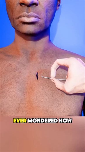 Sachin Singh Negi on Instagram: "How to peacemaker is installed 3d animation it's reels for education purpose only ❤️‍🩹👍 #twins #medstudents #viral #trending #explore #reelsinstagram #shorts #healthcare #explorepage #sachinsinghnegiofficial #medicalknowledge #animation #surgery #peacemaker #installed"