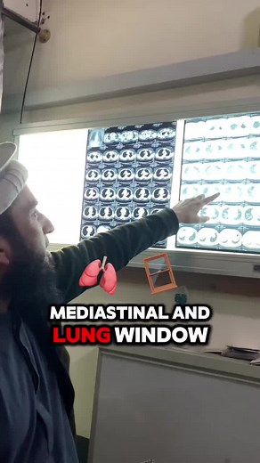 Understanding CT Scans of the Thorax