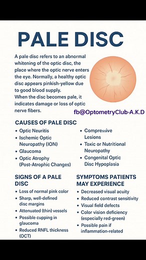 30K views · 232 reactions | What is Pale Disc (Optic Disc Pallor) ?...