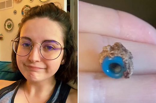 Woman's booger is a bead she stuck up her nose 20 years ago