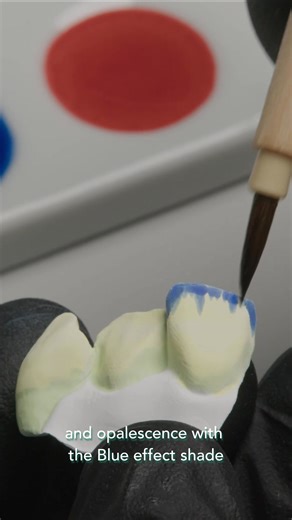🎨 Watch the video to see just how simple it is to master the paintingtechnique with GC Initial Zirconia Coloring Liquid. With just a few easy steps, you can enhance depth, translucency, and natural character in your pre-sintered zirconia crowns.Achieving lifelike results that impress patients and elevate your restorations — it’s that easy!#GCInitial #ZirconiaArtistry #RestorativeDentistry #DentalExcellence #SmileDesign | GC Europe