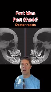Share with a friend who thinks THEY have bad teeth 😬 credit IG @Savage Paramedics #teethtok #dentistry | J Mack Slaughter Jr