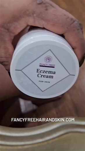🌿 Meet our founder, @iyonnawoods! Driven by her own battle with chronic eczema and skepticism about long-term steroid use, she crafted a natural eczema treatment cream that transformed her family's skin—and it can do the same for yours! 💚✨ Say goodbye to flare-ups and hello to soothing relief. #EczemaSolution #NaturalHealing #FamilyCare #FancyFreeHairAndSkin #FancyAndFreeOfHarshChemicals #MadeInBaltimore #BlackGirlMagic #ContractManufacturing #PrivateLabelManufacturing #GMPCertified #SixFigure