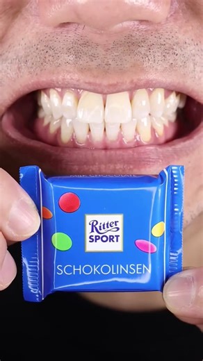 ASMR | Ritter Sport Milk Chocolate with Multi Hue Sugar Pearls!#Doctor Tristan Peh#ASMR#Ritter Sport