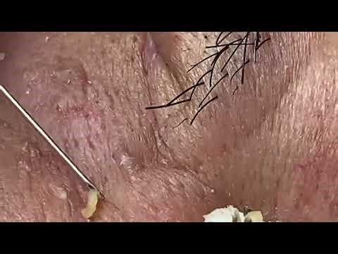 Relax and Satisfying with Loan Nguyen Spa Treatment #1004