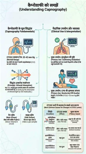 Capnography #Capnography#medical #DOTT#paramedical #nursing #students #studytips #shortsfeed #viral