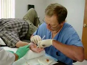 Miracle 20-minute Medical Procedure Reverses Hand Disorder