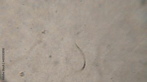 Bacteria Parasites and Worms in drinking Water under Microscope. nematode Worm under Microscope, Parasites Among Roundworms: Roundworms, Pinworms, Trichinella. Environmental Pollution.