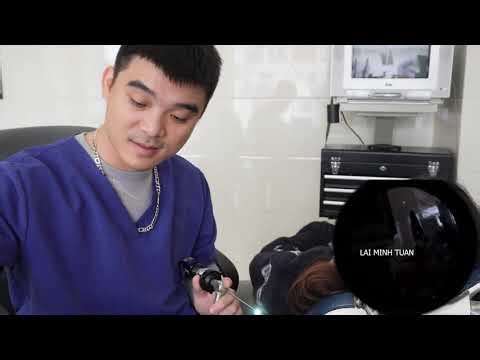 EAR CANAL FUNGAL INFECTION AND EAR ECZEMA 🌀 耳かき - ASMR Ear Cleaning | Doctor: Lai Minh Tuan