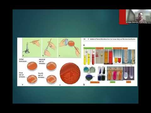 CDE 99: Evolution of Automation in Microbiology