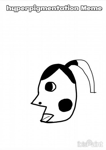 hyperpigmentation drawing Meme