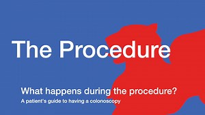 Colonoscopy 3 The Procedure 3m00s v2